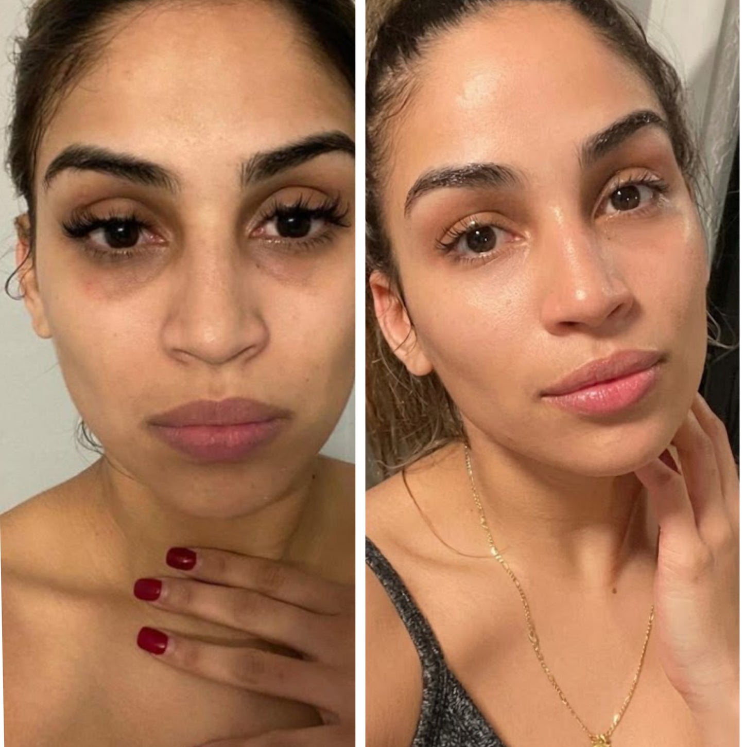 Dark Circles GHK-Cu Peptide Serum