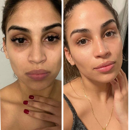 Dark Circles GHK-Cu Peptide Serum