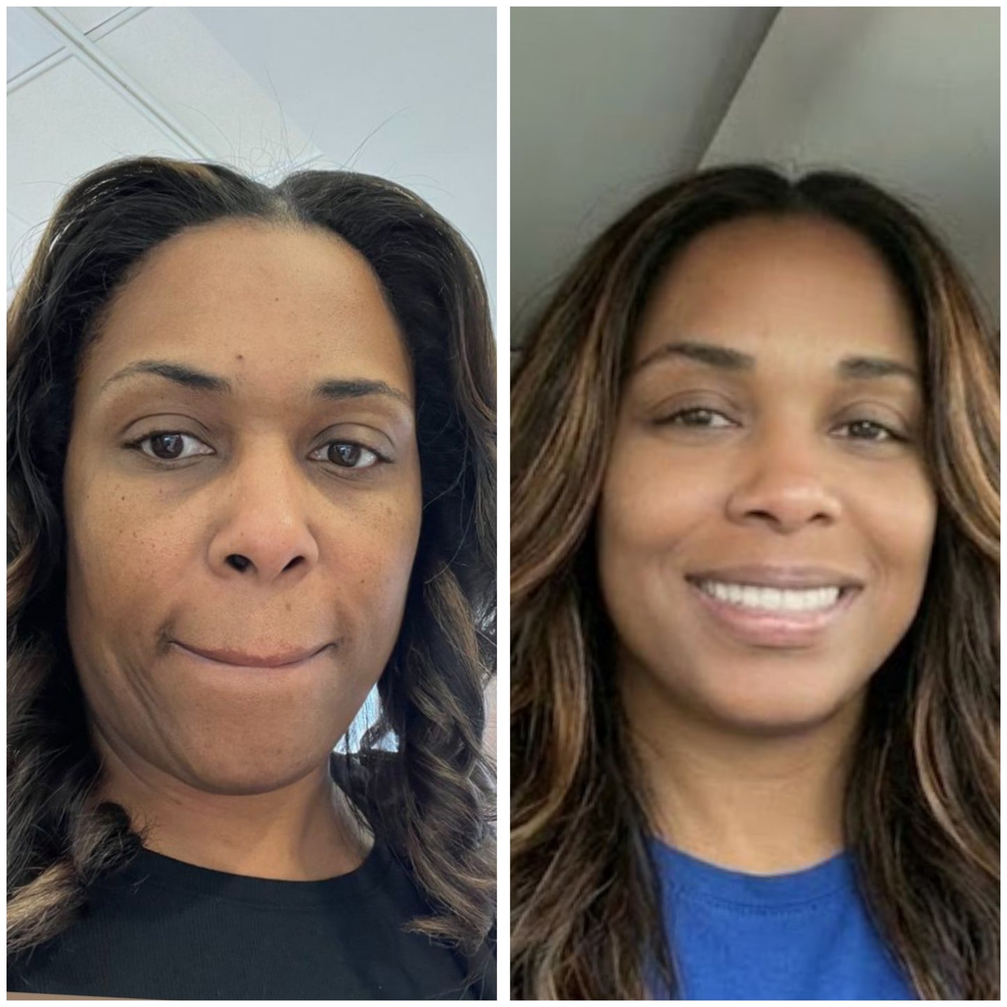 Dark Circles GHK-Cu Peptide Serum