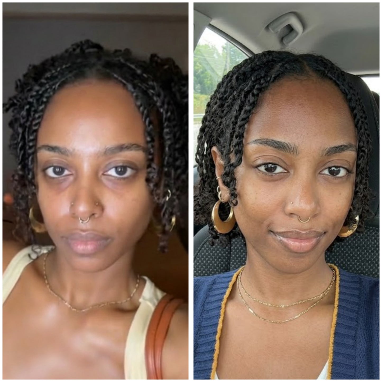 Dark Circles GHK-Cu Peptide Serum