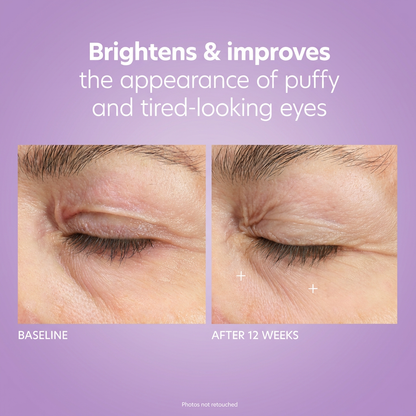 Korean Micro-infusion Eye Patches