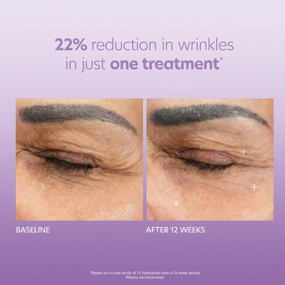 Korean Micro-infusion Eye Patches